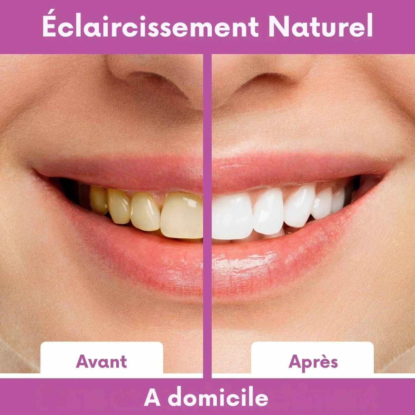 WhiteSmile™ - Bandes de blanchiment dentaire